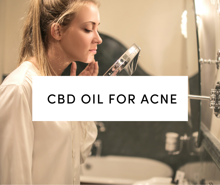 cbd for acne